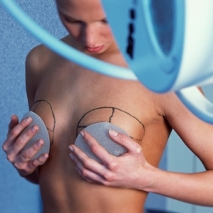 breast-augmentation-side-effects