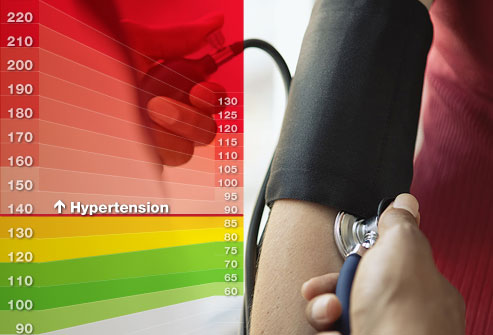 photolibrary_rf_photo_of_hypertension_symptoms